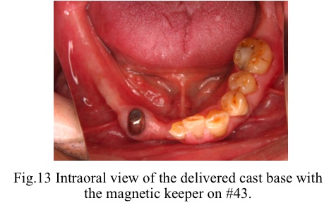 [fig13]