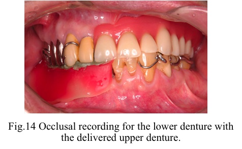 [fig14]