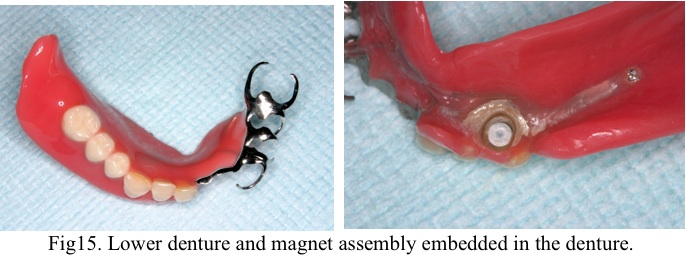 [fig15]