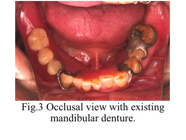 [fig3]