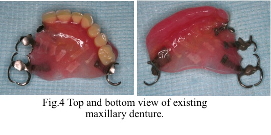 [fig4]