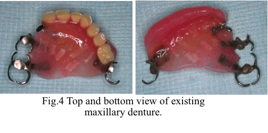 [fig4]